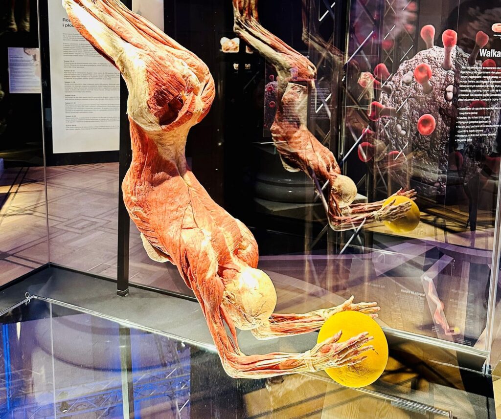 fot. Wystawa BODY Worlds